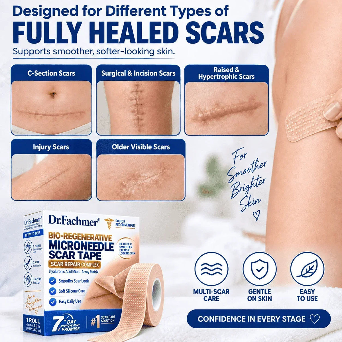 🦄⚕️𝐎𝐟𝐟𝐢𝐜𝐢𝐚𝐥 𝐒𝐭𝐨𝐫𝐞丨Dr.Fachmer® 🩹 Bio-Regenerative Microneedle Scar Tape——Remove all kinds of skin scars