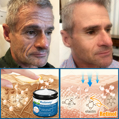 💯Official Store: Rolimey® Magnesium Skin Repair Cream (Smooths Wrinkles, Improves Skin Firmness, Tightens Skin)