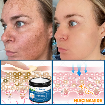 💯Official Store: Rolimey® Magnesium Skin Repair Cream (Smooths Wrinkles, Improves Skin Firmness, Tightens Skin)