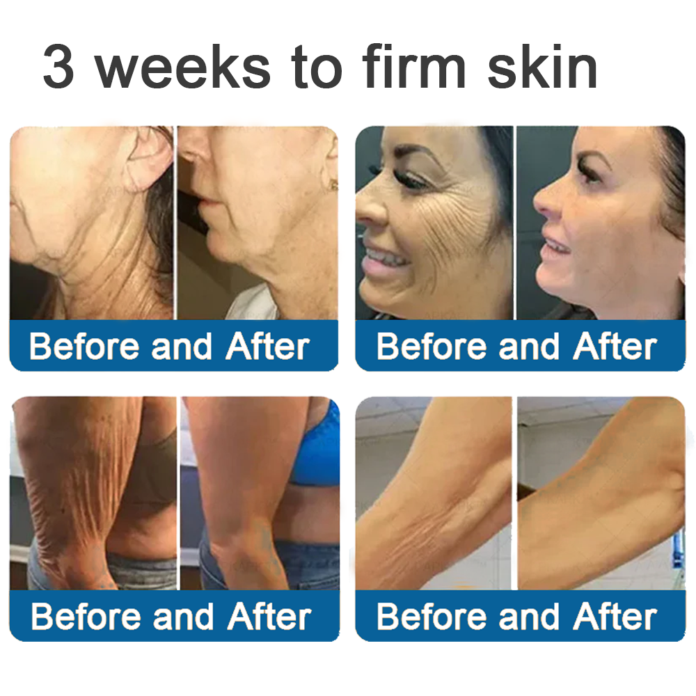 💯Official Store: Rolimey® Magnesium Skin Repair Cream (Smooths Wrinkles, Improves Skin Firmness, Tightens Skin)