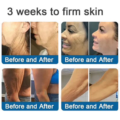 💯Official Store: Rolimey® Magnesium Skin Repair Cream (Smooths Wrinkles, Improves Skin Firmness, Tightens Skin)
