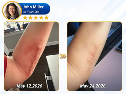 🦄⚕️𝐎𝐟𝐟𝐢𝐜𝐢𝐚𝐥 𝐒𝐭𝐨𝐫𝐞丨Dr.Fachmer® 🩹 Bio-Regenerative Microneedle Scar Tape——Remove all kinds of skin scars