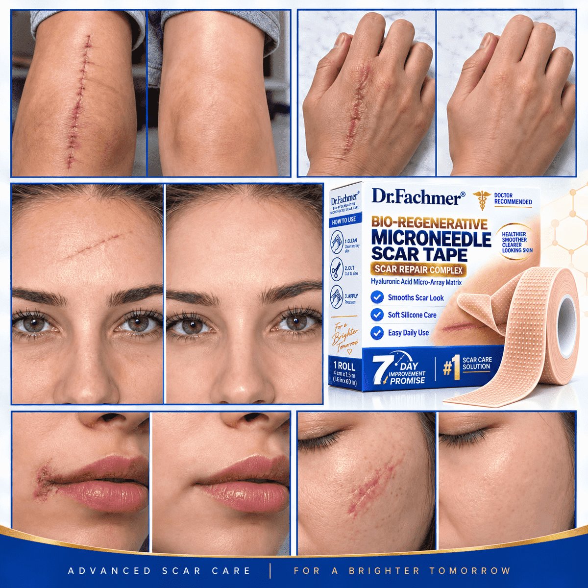 🧑‍⚕️Dr.Fachmer® Bio-Regenerative Microneedle Scar Tape