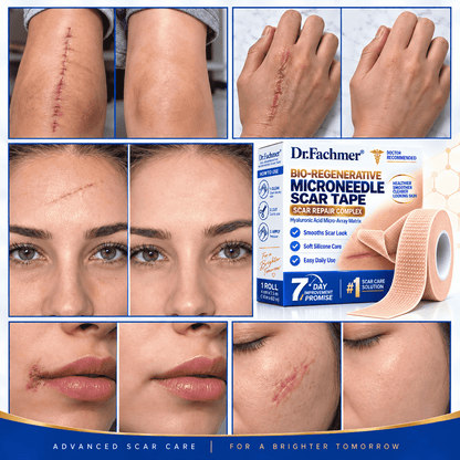 🦄⚕️𝐎𝐟𝐟𝐢𝐜𝐢𝐚𝐥 𝐒𝐭𝐨𝐫𝐞丨Dr.Fachmer® 🩹 Bio-Regenerative Microneedle Scar Tape——Remove all kinds of skin scars